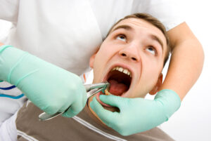 Cost of wisdom teeth removal without insurance